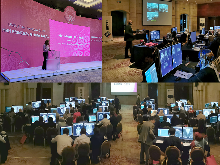 Jordan Breast Cancer Program's (JBCP) Multidisciplinary Workshops 2019 - Multimodalities Detection and Diagnosis of Breast Disease Combined with Hands-On Breast MRI and Tomosynthesis - Amman, Jordan